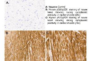 Immunohistochemistry with anti-myosin pS19/pS20 antibody showing strong cytoplasmic staining of myocytes in mouse heart muscle 20x and 40x (B & C). (Myosin anticorps  (pSer19, pSer20))