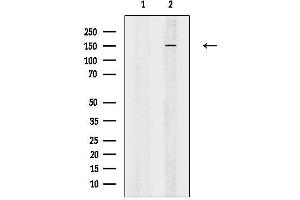 anti-Attractin (ATRN) (N-Term) antibody
