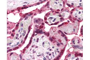 Anti-ENT1 antibody IHC of human placenta. (SLC29A1 anticorps  (Internal Region))