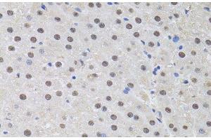 Immunohistochemistry of paraffin-embedded Rat liver using HUS1 Polyclonal Antibody at dilution of 1:100 (40x lens).