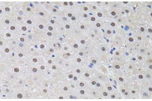 Immunohistochemistry of paraffin-embedded Rat liver using HUS1 Polyclonal Antibody at dilution of 1:100 (40x lens). (HUS1 anticorps)