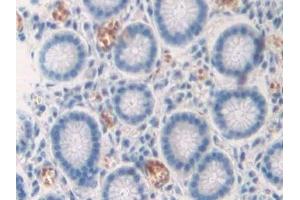 Detection of CD299 in Human Stomach Tissue using Polyclonal Antibody to Cluster Of differentiation 299 (CD299)