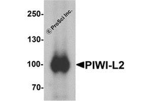 Western Blotting (WB) image for anti-Piwi-Like 2 (PIWIL2) (Middle Region) antibody (ABIN1031041) (PIWIL2 anticorps  (Middle Region))