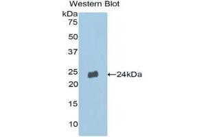 Western Blotting (WB) image for anti-Matrix Metallopeptidase 13 (Collagenase 3) (MMP13) (AA 290-468) antibody (ABIN1859847) (MMP13 anticorps  (AA 290-468))