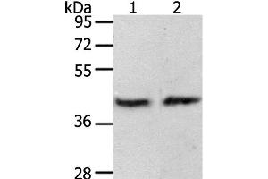 Western Blot analysis of MCF7 cell and Mouse brain tissue using PAX8 Polyclonal Antibody at dilution of 1:250 (PAX8 anticorps)