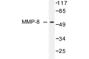 Image no. 1 for anti-Matrix Metallopeptidase 8 (Neutrophil Collagenase) (MMP8) antibody (ABIN265533) (MMP8 anticorps)