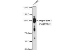Western blot analysis of extracts of HUVEC cells, using Integrin beta 3 (ITGB3/CD61) antibody (ABIN6127572, ABIN6142584, ABIN6142586 and ABIN6219636) at 1:1000 dilution. (Integrin beta 3 anticorps  (AA 610-718))