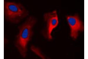 Immunofluorescent analysis of 14-3-3 zeta staining in MCF7 cells. (14-3-3 zeta anticorps  (C-Term))