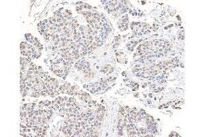 anti-Chromodomain Helicase DNA Binding Protein 8 (CHD8) (AA 325-350) antibody