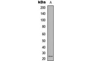 Western blot analysis of IL-12A expression in MDA-MB231 (A) whole cell lysates.
