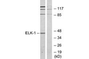 Western blot analysis of extracts from HeLa cells, treated with heat shock, using Elk1 (Ab-389) Antibody. (ELK1 anticorps  (AA 356-405))