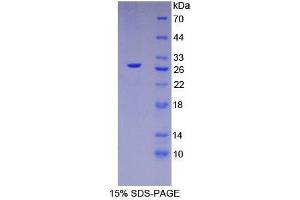 SDS-PAGE analysis of Human HNF4a Protein. (HNF4A Protéine)