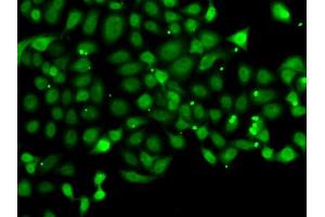 Immunofluorescence analysis of MCF7 cell using PDCD5 antibody. (PDCD5 anticorps)
