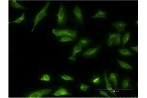 Immunofluorescence of monoclonal antibody to ETNK1 on HeLa cell.
