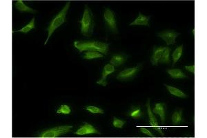 Immunofluorescence of monoclonal antibody to ETNK1 on HeLa cell. (Ethanolamine Kinase 1 anticorps  (AA 133-228))