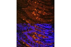 Immunofluorescence analysis of rat Intestine using TLN1 antibody (ABIN1683044, ABIN3018627, ABIN3018628 and ABIN6220520) at dilution of 1:100.