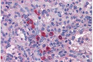 Human Spleen: Formalin-Fixed, Paraffin-Embedded (FFPE)