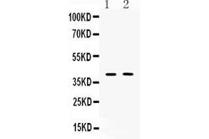 Western blot analysis of Islet 1 expression in PC12 whole cell lysates ( Lane 1) and MCF-7 whole cell lysates ( Lane 2). (ISL1 anticorps  (Middle Region))