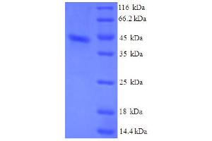 SDS-PAGE (SDS) image for Serum Amyloid A (SAA) (AA 19-129) protein (His-GST) (ABIN5710308) (SAA Protein (AA 19-129) (His-GST))