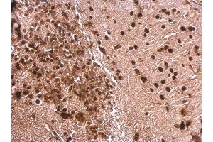 IHC-P Image MEF2A antibody [C2C3], C-term detects MEF2A protein at nucleus on mouse fore brain by immunohistochemical analysis. (MEF2A anticorps  (C-Term))
