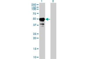 Western Blot analysis of STAM expression in transfected 293T cell line by STAM monoclonal antibody (M01), clone 2B11-1G1. (STAM anticorps  (AA 1-403))