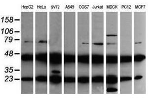Image no. 2 for anti-Mitogen-Activated Protein Kinase Kinase 1 (MAP2K1) antibody (ABIN1499377) (MEK1 anticorps)