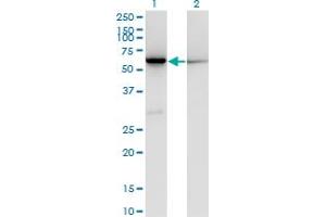 Western Blot analysis of CBS expression in transfected 293T cell line by CBS monoclonal antibody (M02), clone 3D10. (CBS anticorps  (AA 1-100))