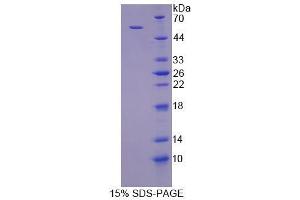 SDS-PAGE analysis of Human TGOLN2 Protein. (TGOLN2 Protéine)