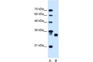 WB Suggested Anti-CBR1 Antibody Titration:  1. (CBR1 anticorps  (C-Term))