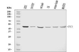 Western blot analysis of ZIC1 using anti-ZIC1 antibody (ABIN7600166).