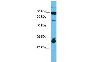Western Blotting (WB) image for anti-Rap Guanine Nucleotide Exchange Factor (GEF)-Like 1 (RAPGEFL1) (C-Term) antibody (ABIN2791893) (RAPGEFL1 anticorps  (C-Term))
