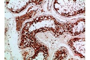 Immunohistochemical analysis of paraffin-embedded human-testis, antibody was diluted at 1:200