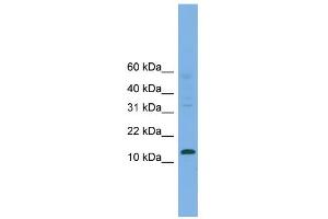 WB Suggested Anti-CRABP2 Antibody Titration:  0.