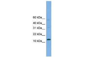 WB Suggested Anti-CRABP2 Antibody Titration:  0. (CRABP2 anticorps  (Middle Region))