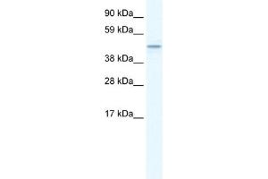 WB Suggested Anti-TMEM108 Antibody Titration:  1. (TMEM108 anticorps  (Middle Region))