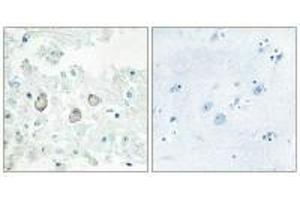 Immunohistochemistry analysis of paraffin-embedded human brain tissue using DOK7 antibody.