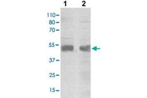 The tissue/cell lysates derived from mouse brain (lane 1), HeLa (lane 2) were immuno-probed by SOCS4 polyclonal antibody  at 1 : 500. (SOCS4 anticorps  (C-Term))