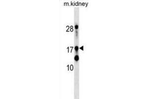 Western Blotting (WB) image for anti-TATA-Binding Protein-Associated Phosphoprotein (DR1) antibody (ABIN2999733)