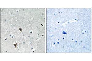 Immunohistochemistry analysis of paraffin-embedded human brain tissue using OXR1 antibody. (OXR1 anticorps  (Internal Region))