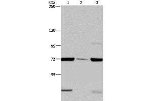 Western Blot analysis of LoVo cell, Human testis tissue and A549 cell using FAAH Polyclonal Antibody at dilution of 1:400 (FAAH anticorps)