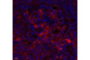 Immunofluorescence of paraffin embedded human tonsil using MS4A2 (ABIN7074594) at dilution of 1: 400 (400x lens)