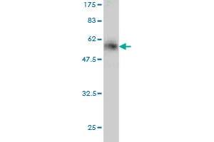 Western Blot detection against Immunogen (52.