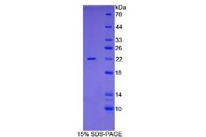 SDS-PAGE analysis of Human Cofilin 1, Non Muscle Protein.