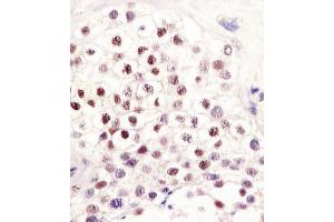 Antibody staining LIN28B in human testis tissue sections by Immunohistochemistry (IHC-P - paraformaldehyde-fixed, paraffin-embedded sections).