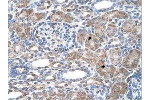 Immunohistochemistry (IHC) image for anti-Interferon-Induced Protein 44-Like (IFI44L) (N-Term) antibody (ABIN2782525)