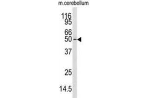 Western Blotting (WB) image for anti-Calcium/calmodulin-Dependent Protein Kinase Kinase 1, alpha (CAMKK1) antibody (ABIN3003479) (CAMKK1 anticorps)