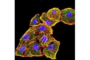 Immunofluorescence analysis of Hela cells using KRT6A mouse mAb (green).