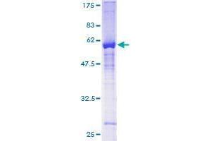 Image no. 1 for Zinc Finger Protein 277 (ZNF277) (AA 1-278) protein (GST tag) (ABIN1326063)