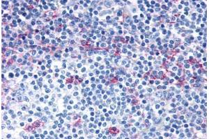 Anti-CCR7 antibody  ABIN1048400 IHC staining of human lymph node. (CCR7 anticorps  (C-Term))