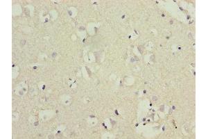 Immunohistochemistry of paraffin-embedded human brain tissue using ABIN7148625 at dilution of 1:100 (CRHR1 anticorps  (AA 24-121))